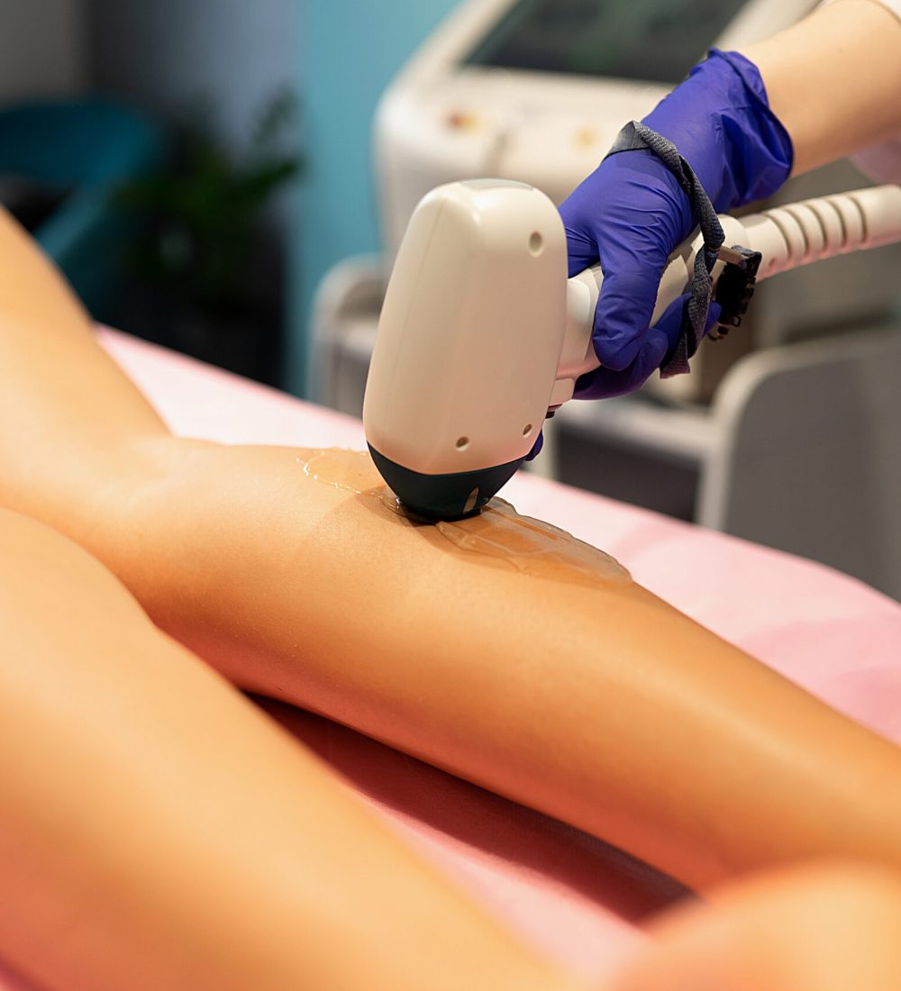 Laser depilation leg hair removal therapy